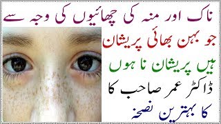 chere ke chayan khatam krnay ka taria remove acni and pimple | Urdu New Trend