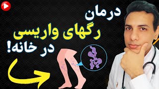 درمان درد و ظاهر رگهای واریسی | Treatment of pain and appearance of varicose veins