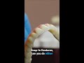 Can you have Snap-In Dentures on either the top or bottom jaw?