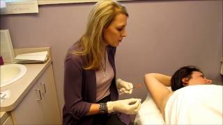 Botox Underarm Sweating Demo