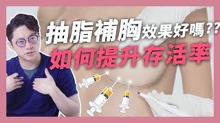 抽脂補胸手術可能脂肪鈣化？ 補脂槍真的有效嗎？｜周杰醫師