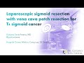 Laparoscopic sigmoid resection with vena cava patch resection for T4 sigmoid cancer