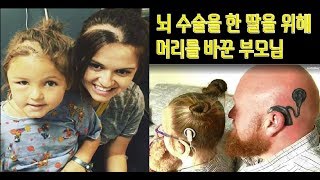 뇌 수술을 한 딸을 위해 머리를 바꾼 엄마와 아빠