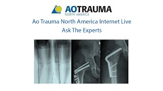 Week 3- Ask the experts: May 7-Proximal Femoral Deformity