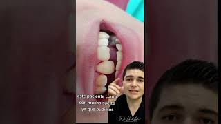 Te golpeaste un diente 🦷 acude con tu dentista inmediatamente