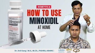 How to Use Minoxidil | Minoxdil Benefits | Stop Your Hair Loss Today!