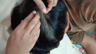 Scalp Searching ASMR - Relax \u0026 Unwind