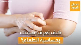 صباح العربية | كيف تعرف أنك تعاني من حساسية الطعام؟