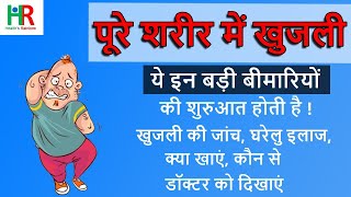 पूरे शरीर में खुजली होने के 20 कारण, जांच, घरेलू और एलोपैथिक इलाज || खुजली को रोकने के लिए क्या खाएं