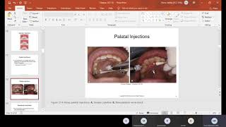CH 37 Anesthesia and Pain Control