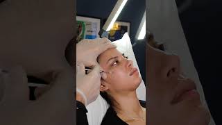 HOW TO ACCENTUATE CHEEK BONES | CHEEK FILLER #cheekfiller #youtubeshorts #shorts