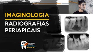 Raio X peripical | Imaginologia para odontologia