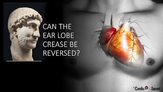 Is the ear lobe crease reversible?