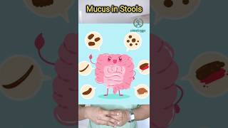 மலத்தில் சளி கலந்து போக காரணம் என்ன| Mucus in Stools causes|IBS| IBD | மலச்சிக்கல் #mucus #ibs #ibd