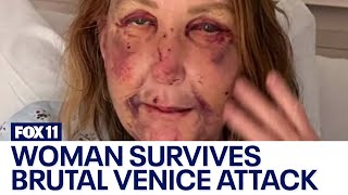 Woman's mouth wired shut after surviving vicious attack in Venice