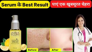 सीरम के फायदे  | Lotus Herbals White Glow Serum Review in hindi | Lotus serum |