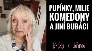 Krása s Jiřinou - Pipínky, milie, komedony a ostatní bubáci