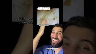 This Is Why You Should Never Bite Your Nails Microscopechallenge