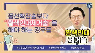 풍선확장술보다는 황색인대제거술을 해야 하는 경우들(척추 치료 밸런스 게임🎮)