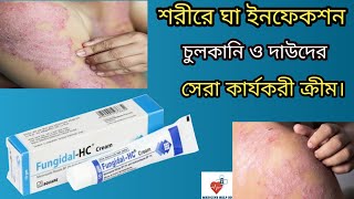 Fungidal hc cream | fungidal hc cream এর কাজ কি | দাউদ চুলকানি ঘা এর  ঔষধ fungidal hc cream