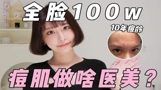 全脸100万！痘肌医美超全讲解！赶紧码住！