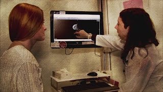 Mammography Guidelines Toned Down by USPSTF
