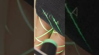 Emerald Laser by Erchonia | Non-Invasive Fat Loss #Shorts