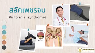 สลักเพชรจม (Piriformis Syndrome) คืออะไร มีอาการยังไง และกายภาพท่าไหน ถึงจะหาย คลิปนี้มีคำตอบครับ