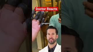 ER Doctor REACTS to \