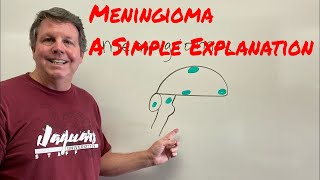 Meningioma A Simple Explanation