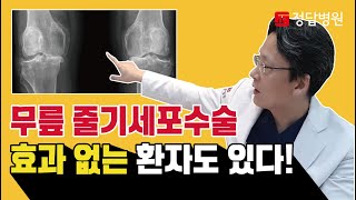 무릎 줄기세포수술 효과가 없는 환자도 있나요?