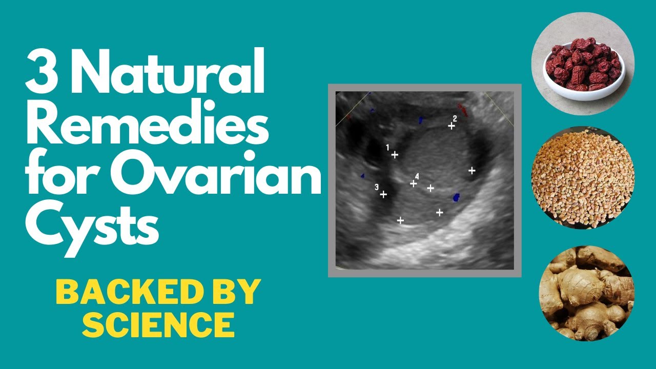 3 Natural Remedies For Ovarian Cysts Backed By Small Scientific Studies ...