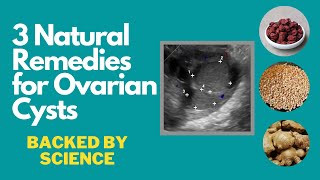 3 Natural Remedies for Ovarian Cysts Backed by Small Scientific Studies