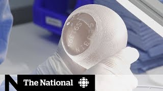 Canadian doctors sounding the alarm over Biocell breast implants | The Implant Files