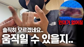 강아지 싸움 말리다 개물림사고로 입원했던 집사의 수술은 잘 됐을까? feat.아빠 웰시코기 이별