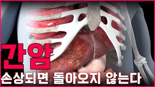 한 번 손상되면 돌아오지 않는 간 | 건강플러스 | 07월 15일