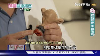 抹片檢查仍有偽陰性 防子宮頸癌可加做「這個」敏感度更高│婦癌健康揭密