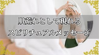 肌トラブルとして届くメッセージ！原因やスピリチュアルな意味とは？【チャンネルダイス】音声付き