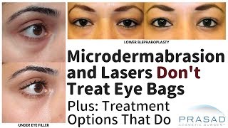 Why Microdermabrasion and Surface Laser Treatments Don't Address Eye Bags, and Options that Do