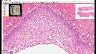 non-keratinized stratified squamous epithelium