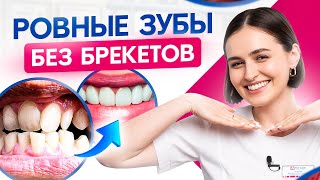 Можно ли выровнять зубы БЕЗ брекетов? (многие не знают об этом!)