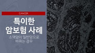 특이한 암보험의 사례: 소액암이 일반암으로 바뀌는 경우