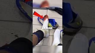 Why do Lamine Yamal's feet bleed every match?