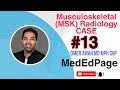 Musculoskeletal (MSK) Radiology CASE #13