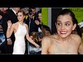 Top 5 Oops Moments Of Emma Watson