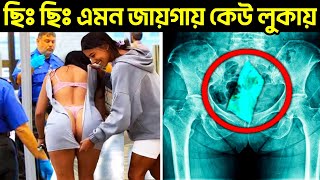 আজব জিনিস যা এক্সরে মেশিনে ধরা পড়েছে | Strangest Things Discovered By X-Rays | Mayajaal bangla