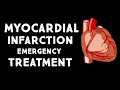 Myocardial Infarction (MI,Heart Attack) Treatment in Emergency | Step wise  STEMI Management USMLE