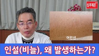 피부증상 - 태선 왜 발생하나?