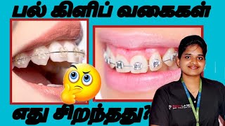 சிறந்த பல் கிளிப் சிகிச்சை ? Teeth braces types and cost in Tamil-(best teeth braces in Tamil)