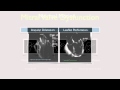 8 Basics of the Mitral Valve